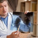 O Que é Cirrose Pulmonar e Tratamento: Causas e Sintomas O Que é Cirrose Pulmonar e Tratamento 1